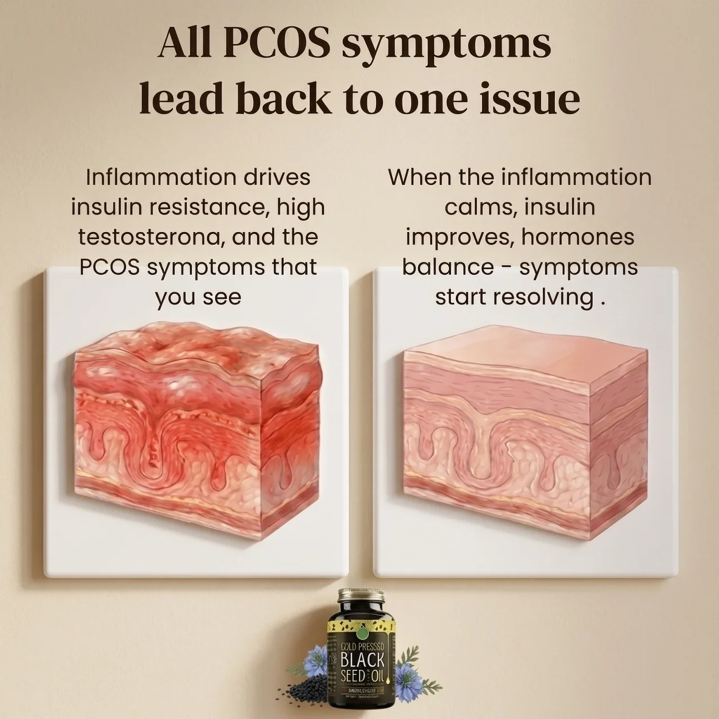 Black Seed Oil PCOS Formula