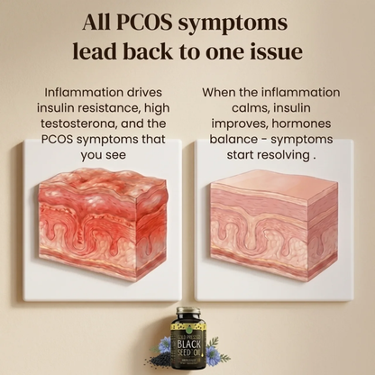 Black Seed Oil PCOS Formula
