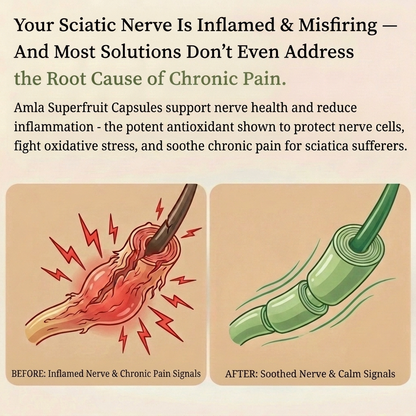 Amla Capsules - Sciatica / Chronic Nerve Pain