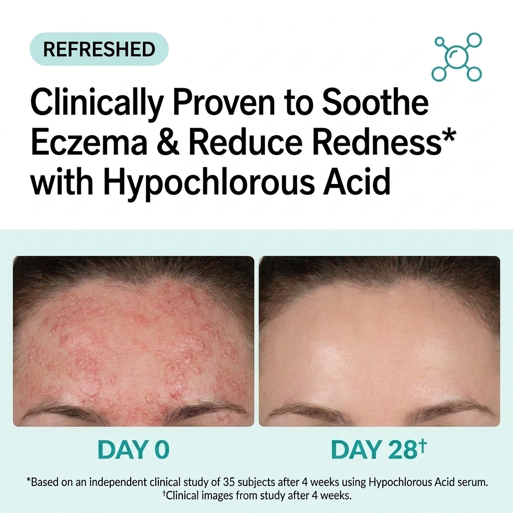 Hypochlorous Acid for Eczema