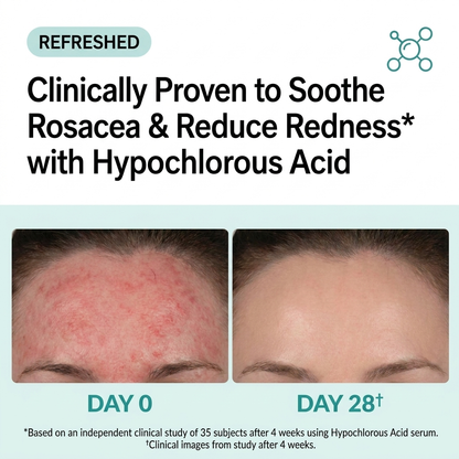 Hypochlorous Acid for Rosacea